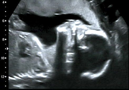 gesichtmuenster Ultraschallbikd des Gesichts - Januar 2011