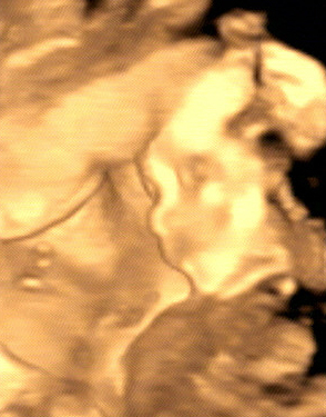 Organultraschall in Münster