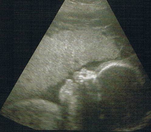 Ultraschallbild-Bodypainting auf dem Babybauch – Shooting