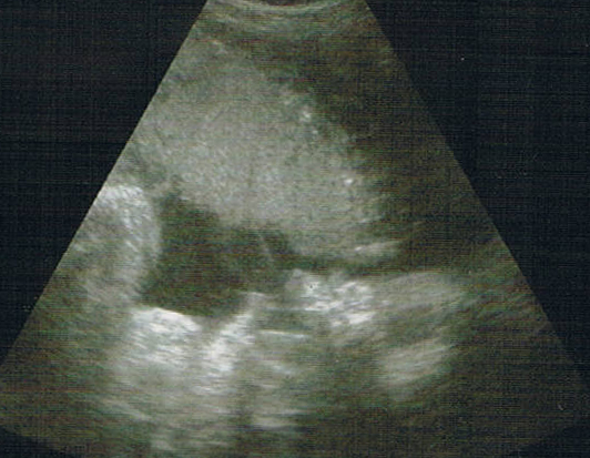 baby_trinken_mutterleib baby_trinken_mutterleib