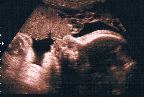 ultraschall_klinik_coesfeld