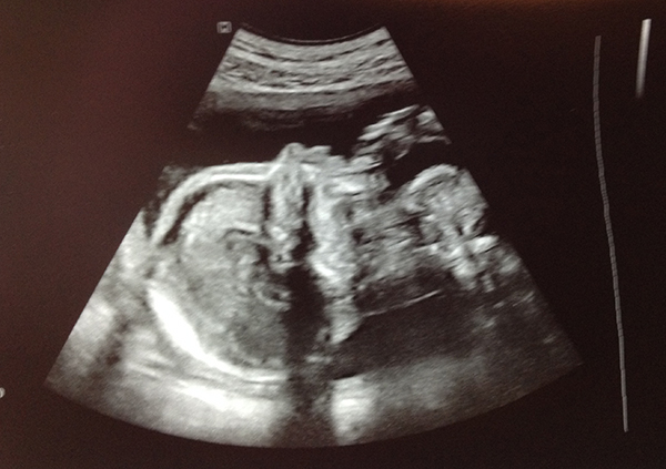 ultraschall oktober 2014